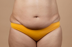 Plastyka brzucha lub mini abdominoplastyka – który zabieg wybrać?